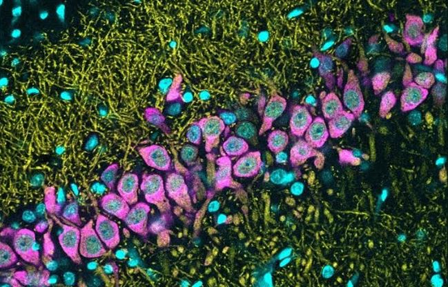 «Iluminando los mapas celulares del hipocampo» Dra. Liset Menéndez de la Prida. 13 de febrero.